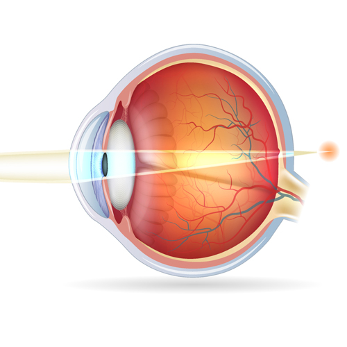 Hyperopia Eye Chart