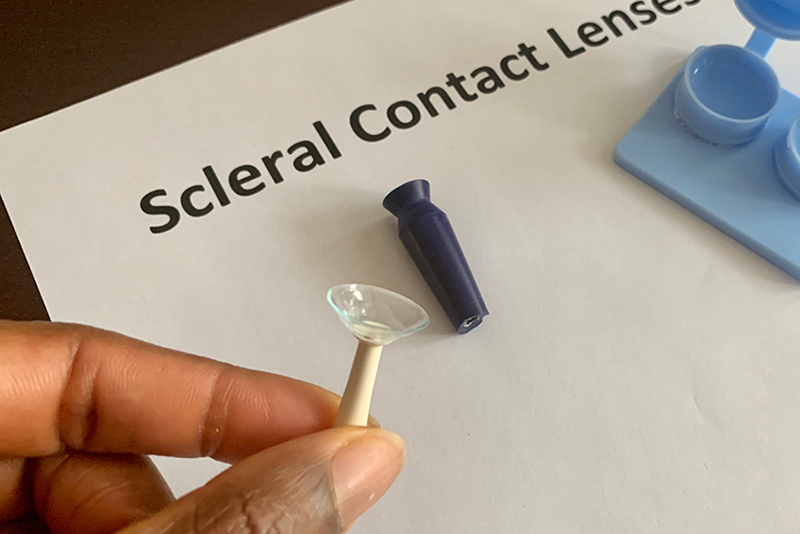 Scleral Contact Lenses for Keratoconus